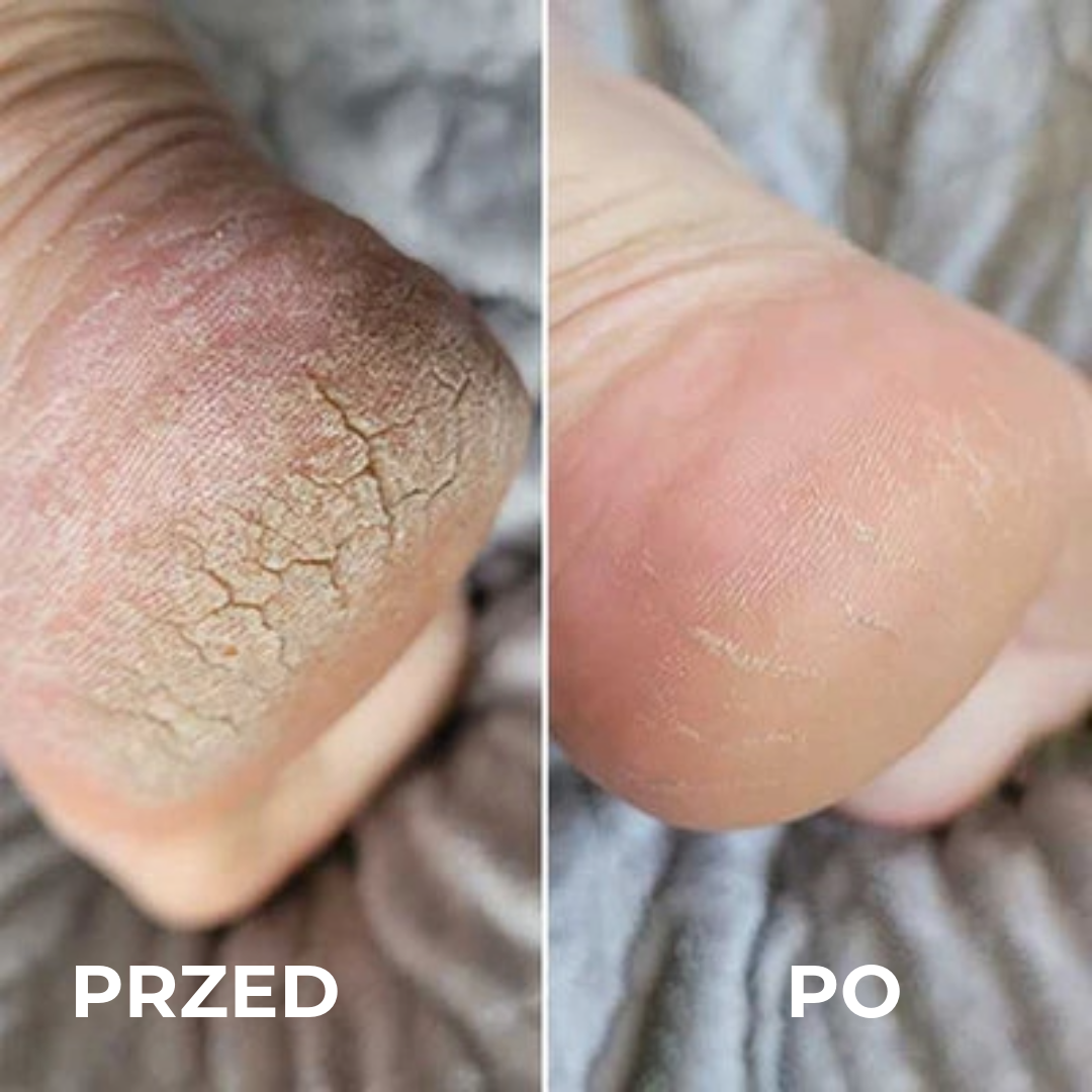 Profesjonalny usuwacz modzeli