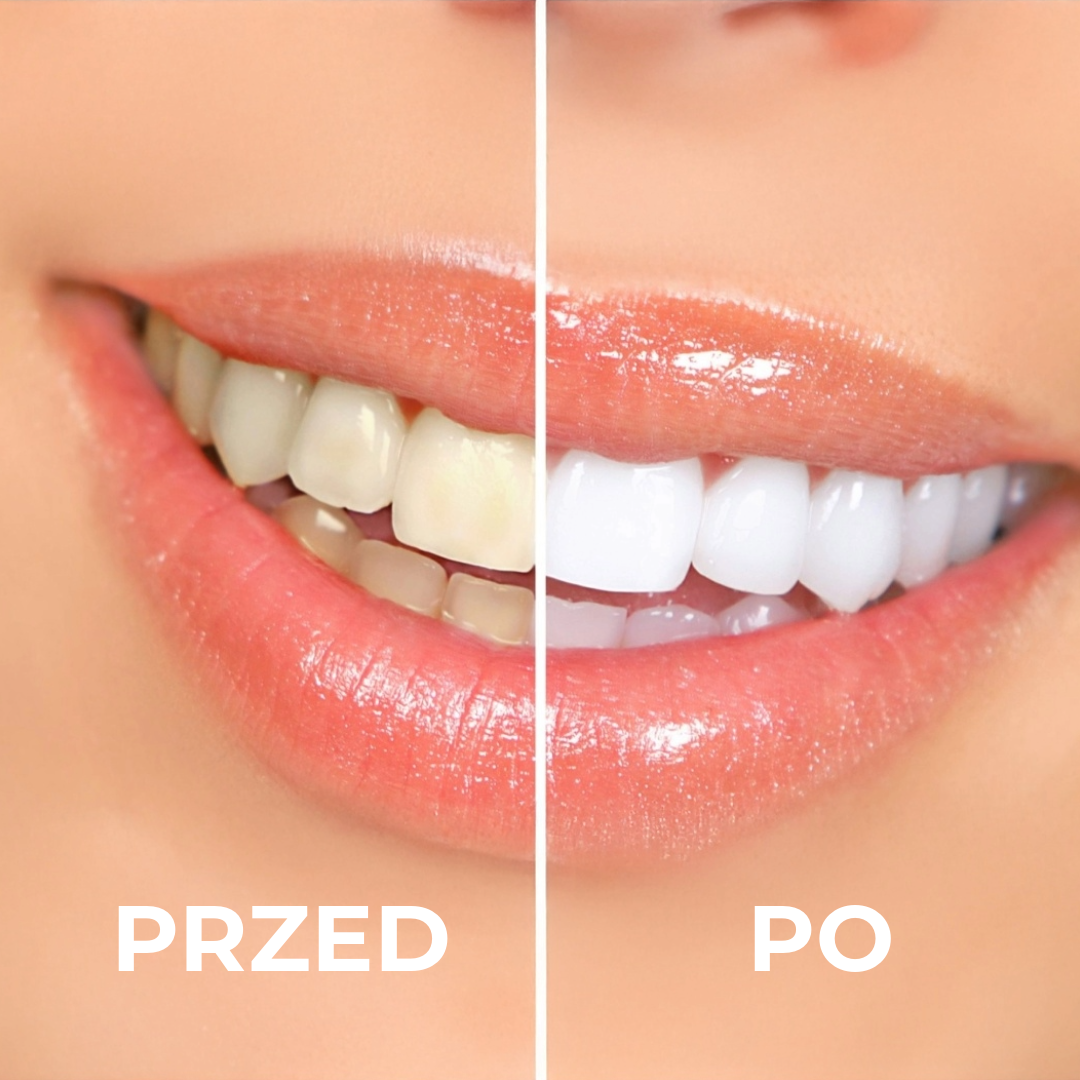 YouBuy™ | Profesjonalny Proszek Wybielający do Zębów