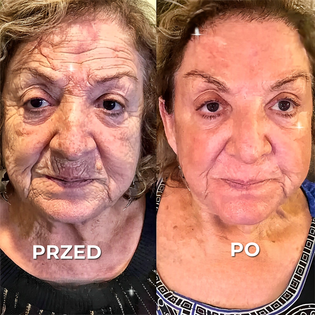 BOTOX™ Krem przeciwzmarszczkowy