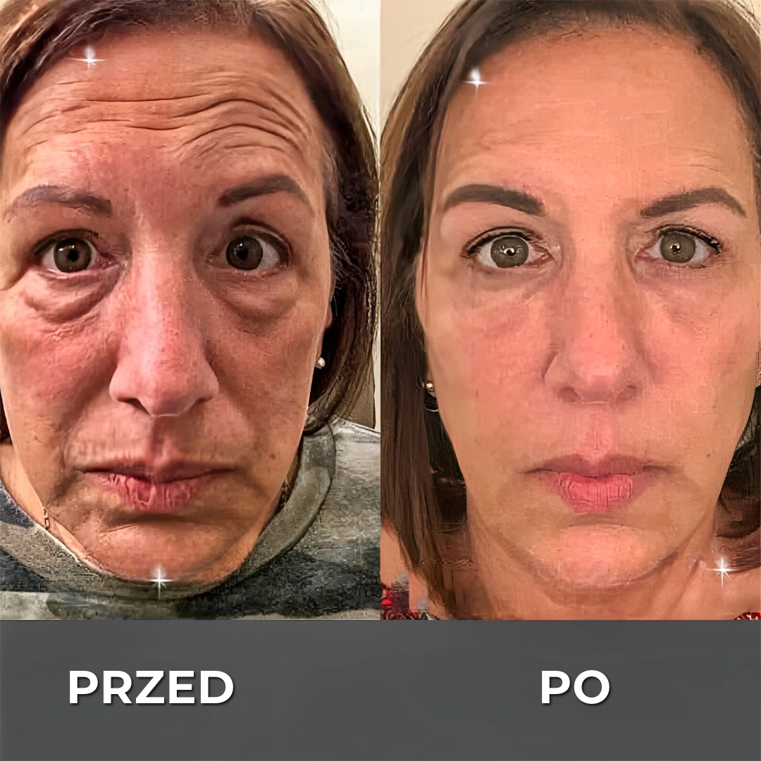 BOTOX™ Krem przeciwzmarszczkowy