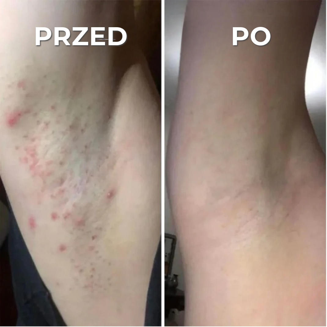 Profesjonalna maszynka do golenia przeciw podrażnieniom