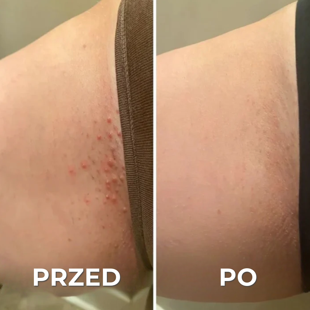 Profesjonalna maszynka do golenia przeciw podrażnieniom