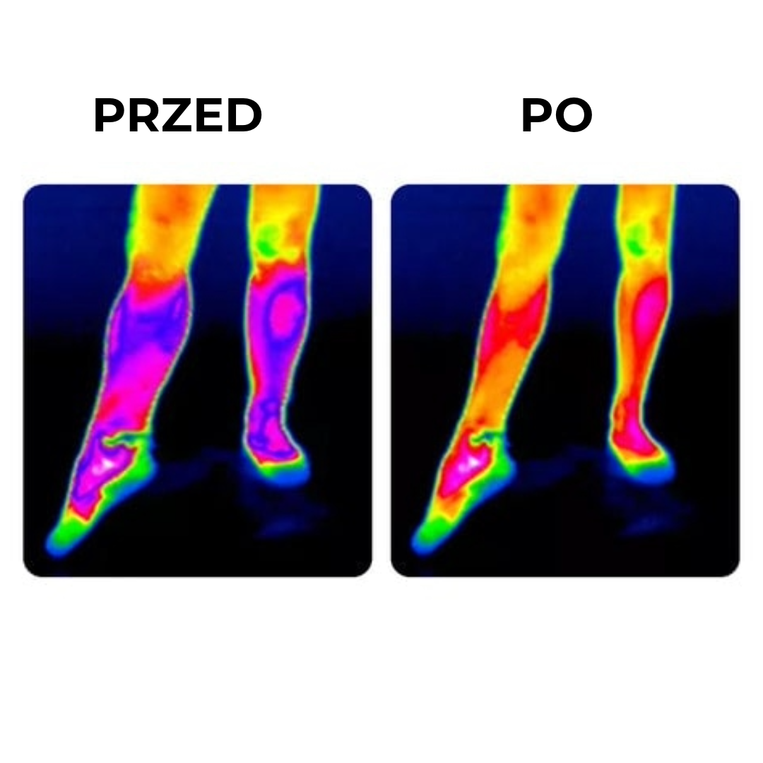 Profesjonalna Samonagrzewająca Się Orteza Stawu Kolanowego