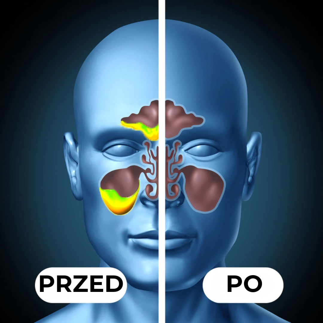 Profesjonalny Oczyszczacz Zatok