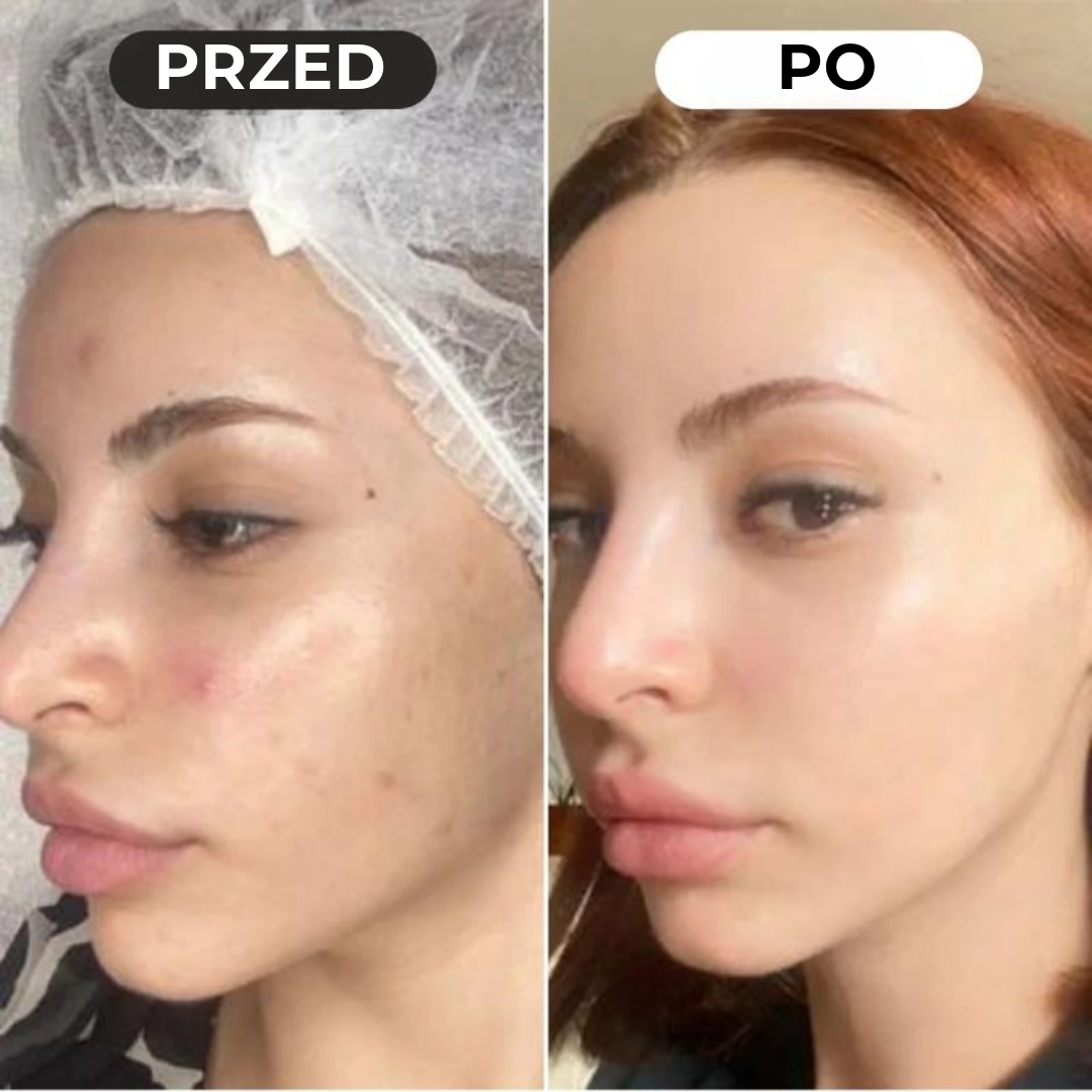 Lumeor™ Maska kolagenowa