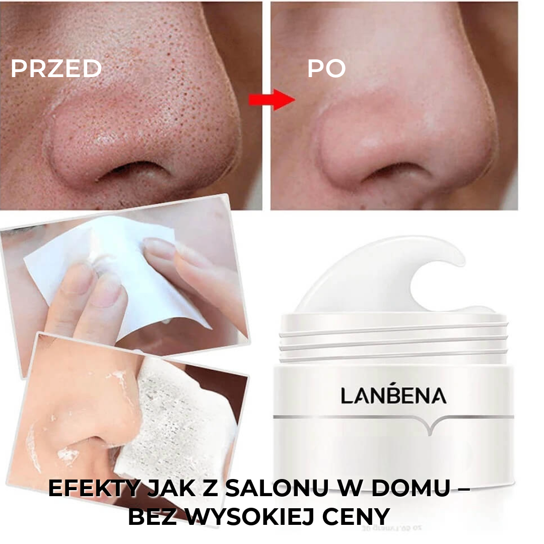 LANBENA™ Maseczka na Wągry 60 Sztuk