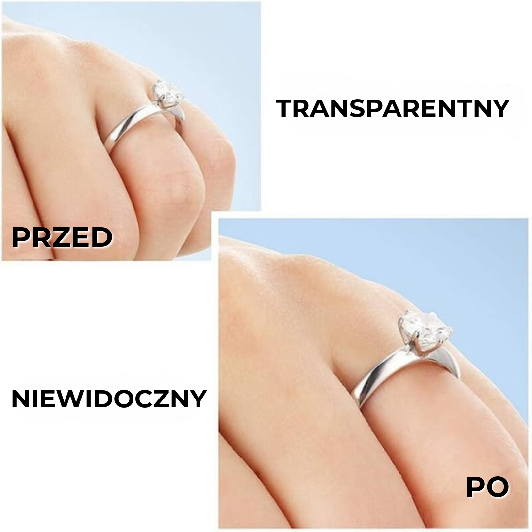 RingFix™ | reduktor pierścionka